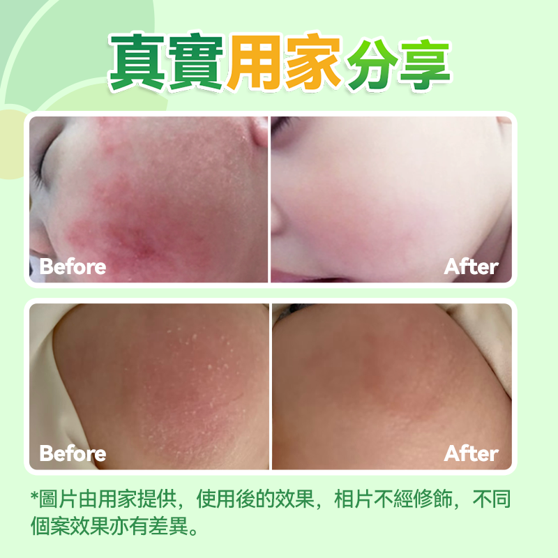 日本Healthive 天然抗敏消紅止癢多用途消炎修護母嬰級皮膚凝膠(120ml)